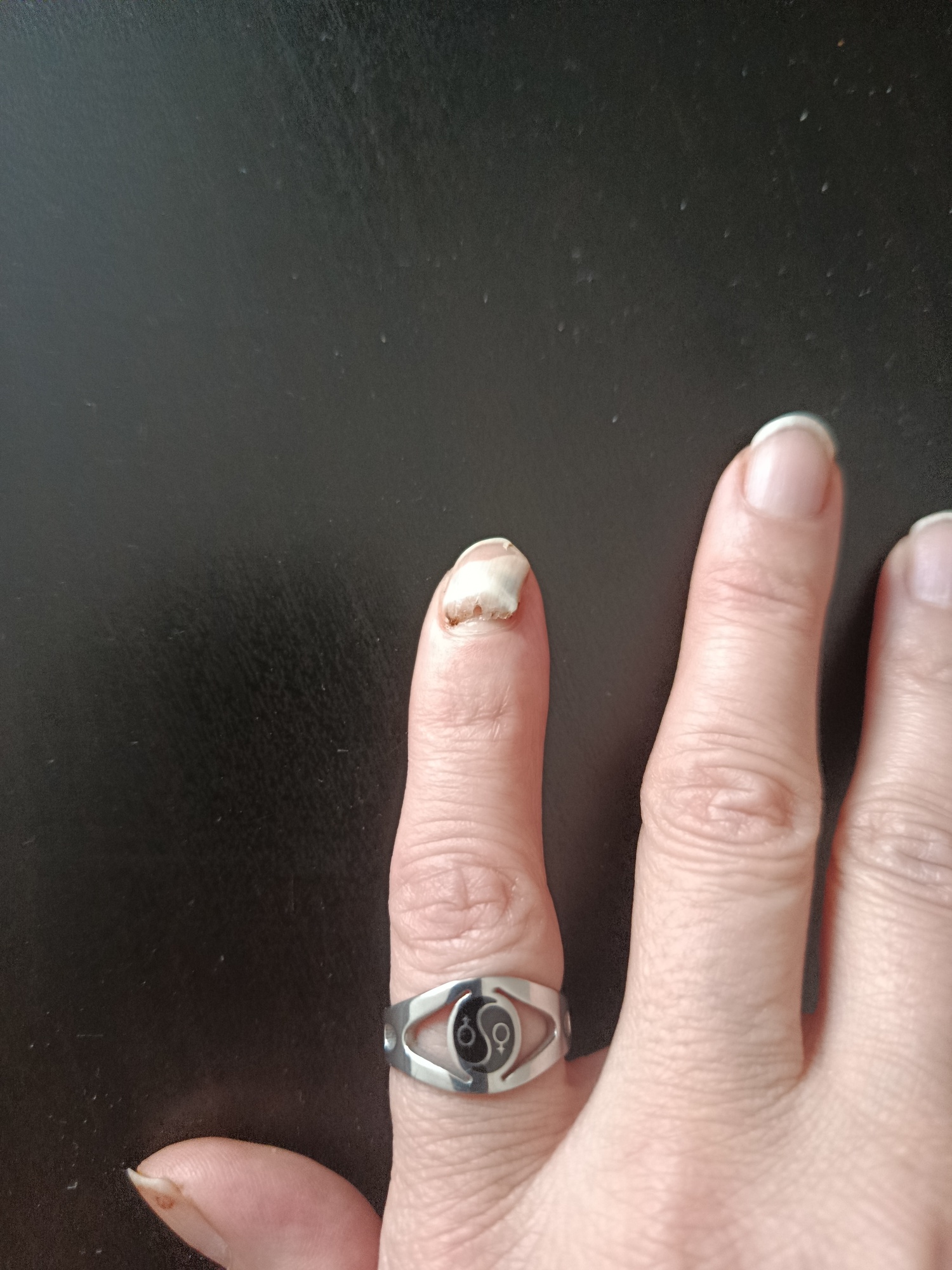 My long and arduous Integrated Camp process ended on June 27, 2025. Therefore, I was assigned to a new municipality for residency. The first day I moved, I had to register at the clinic where my family doctor was located. I went and presented my ID. The secretary then asked for my health insurance card. But I never had that card; it was with the camp administration. I told the secretary I didn't have it. However, she insisted on asking me questions, angrily, on the same subject. I then called my social worker and explained the situation. My social worker wanted to speak to the secretary, but she wouldn't answer the phone or accept the call. Because my German isn't very good, I couldn't express myself clearly. Or maybe the secretary didn't want to understand me. My social worker understood me perfectly. Finally, I turned on the speaker phone, and she had to listen. Then she told me to wait and called me from the living room, addressing me with a harsh and demeaning gesture. All the other patients there looked at me, and I felt very embarrassed. I felt completely alienated and helpless. Anyway, my little registration job was finally done, and I went out. I cried on my first day at my new place. About last month, my finger got stuck in a hard, heavy door. It hurt so bad I thought it was broken. But just because of the possibility of encountering this secretary, I didn't even go to the doctor for a small dressing. Over the next week, it gradually bruised. Finally, it broke at the base. But I didn't go because I was afraid of the secretary. I just wait for it to fall off on its own, and sometimes I just put on a bandage. I think I'm being treated this way because I'm an immigrant and a trans woman.